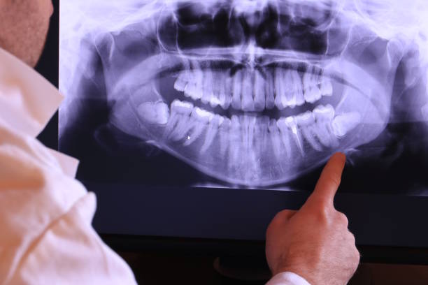 Best Emergency Dentist for Knocked-Out Tooth in Coleman, MI
