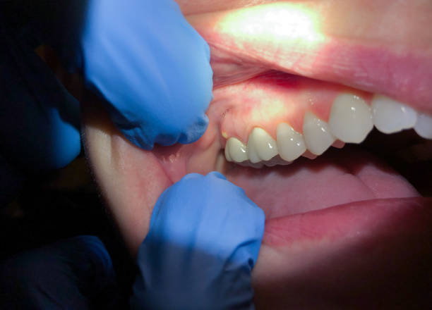 Best Broken or Cracked Tooth Emergency Dentist in Coleman, MI