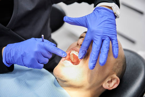 Best Emergency Dentist for Lost Fillings or Crowns in Coleman, MI